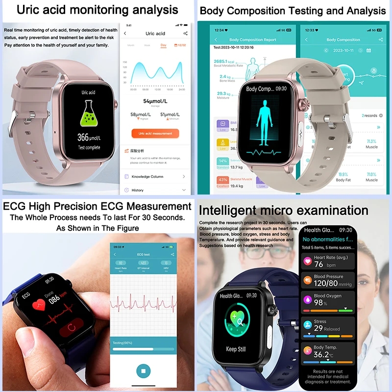 2025 Neu Für XIAOM1 EKG+PPG Bl – Smartwatch Health Watches For Women Bewertung und Preis
